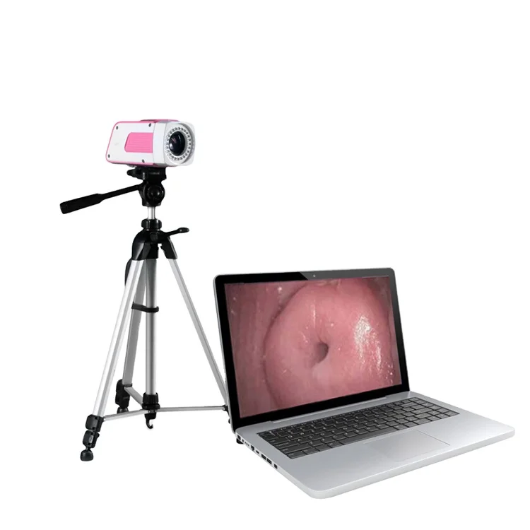 

High resolution MY-F003A Portable Medical Digital Electronic Colposcope price for gynecology