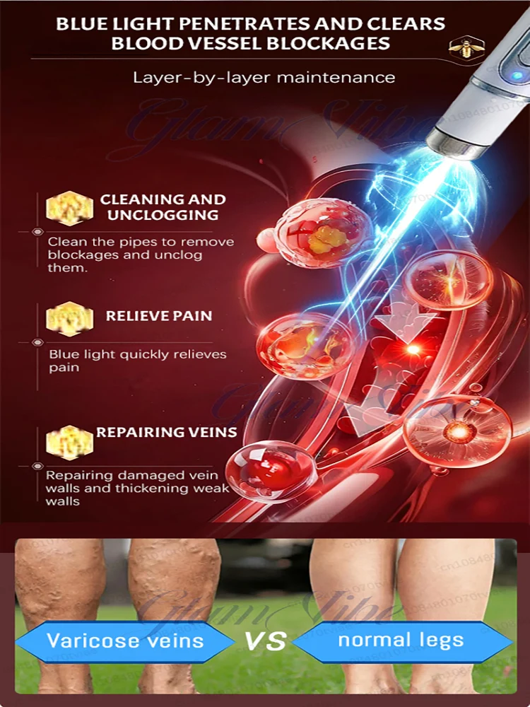 Varicose veins? You'll see changes in just one week! view 4