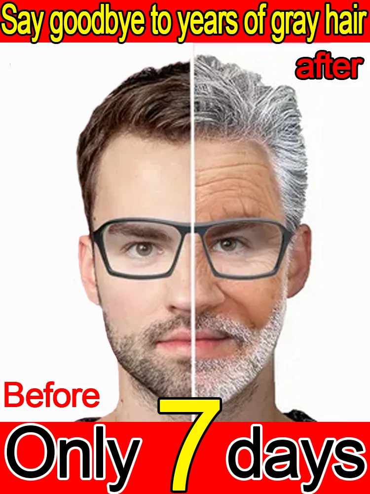 

White hair essence, reduces white hair gently and without irritation, healthy and safe, does not contain allergens.