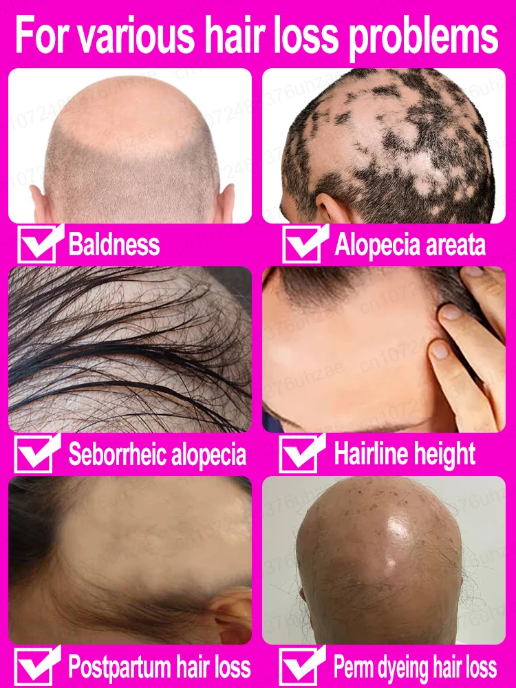 مصل زيادة الشعر