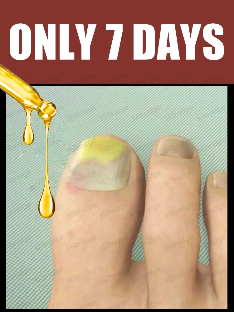 Rajeunseur 2025 - Technologie de prévention des champignons - Contrôle de température et capteur de sécurité réglables