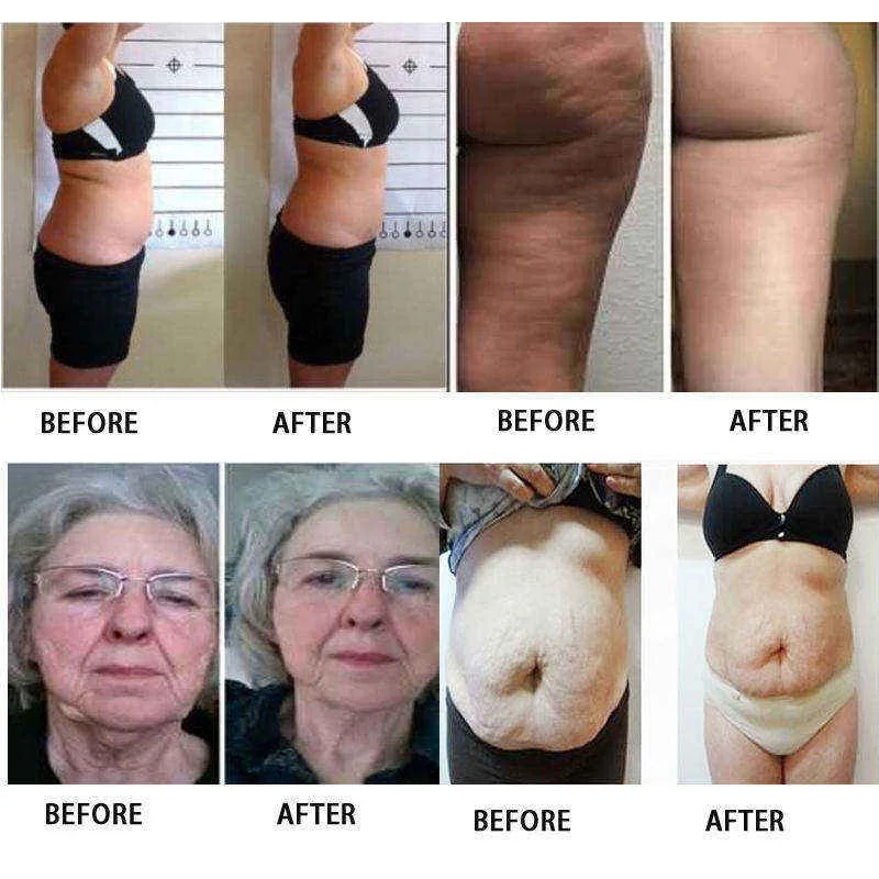 Przenośny laserowy modelator ciała 5D, leczenie światłem, terapia 360° na całe ciało, odchudzanie, liposukcja, pas wyszczuplający.