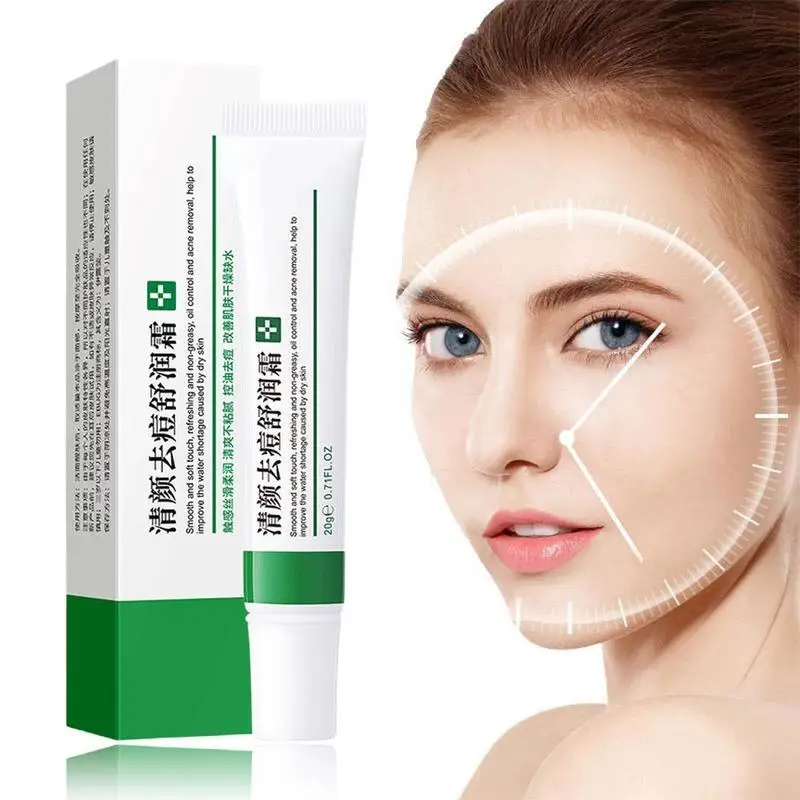 Acne Verwijderingscrème Sproet Crème Krimpen Poriën Whitening Hydraterende Olie Controle Acne Crème Huidverzorging Acne Behandeling Gezichtscrème