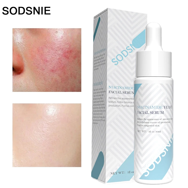 Yeast Face Serum Moisturizing Repair Improves Redness Reduce Fine Lines Remove Dull Firming Whitening Niacinamide Skin Care 30ml