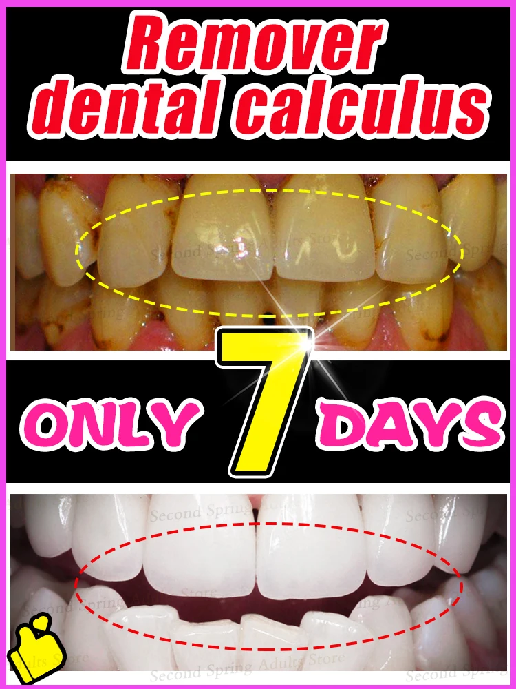 

2025 Hot Products Teeth Whitening Mousse Removes Plaque and Stains Deep Cleans Fresh Breath Oral Hygiene Dental Tools