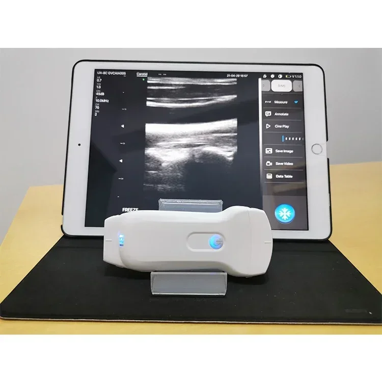 Highest Cost-effective Handheld Portable 3 in 1 Wifi & USB Wireless Ultrasound Probe