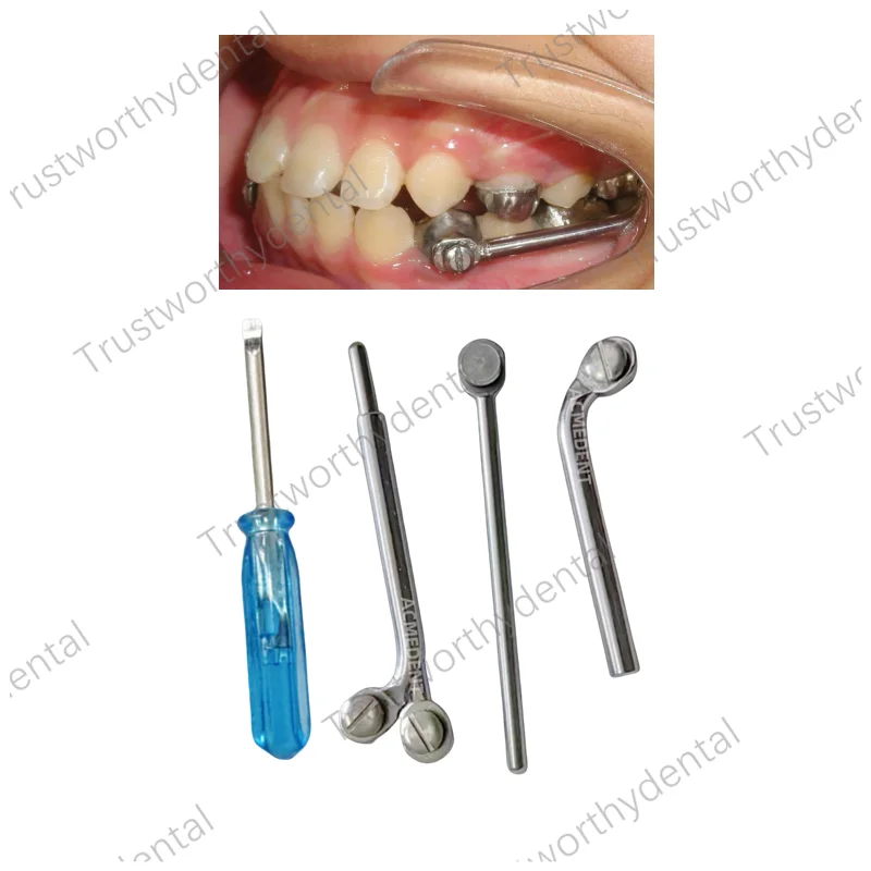 Dental Herbst Appliance Set Dentaurum Sockel Schraube Teleskop kiefer ortho pä dische Klasse II Korrekturen