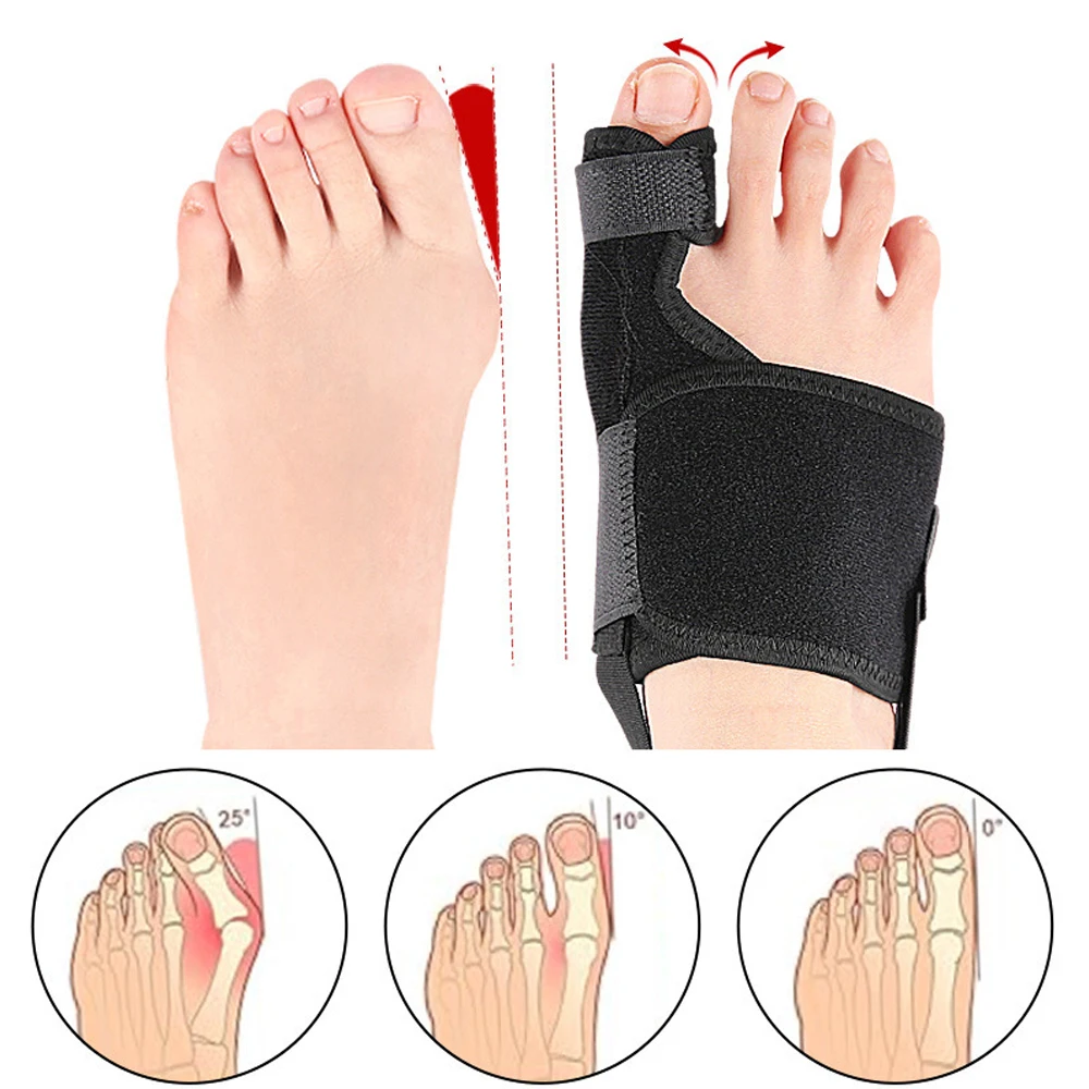 1/2PCS Bunion Corrector - Orthopedic Bunion Splint - Bunion Correction Toe Straightener with Non-slip Strap, Day Night Support