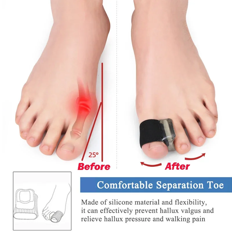 Separatori per dita in Gel correttore per alluce valgo correttore per alluce sovrapposta distanziali per dita in Silicone per alluce e borsite sollievo dal dolore