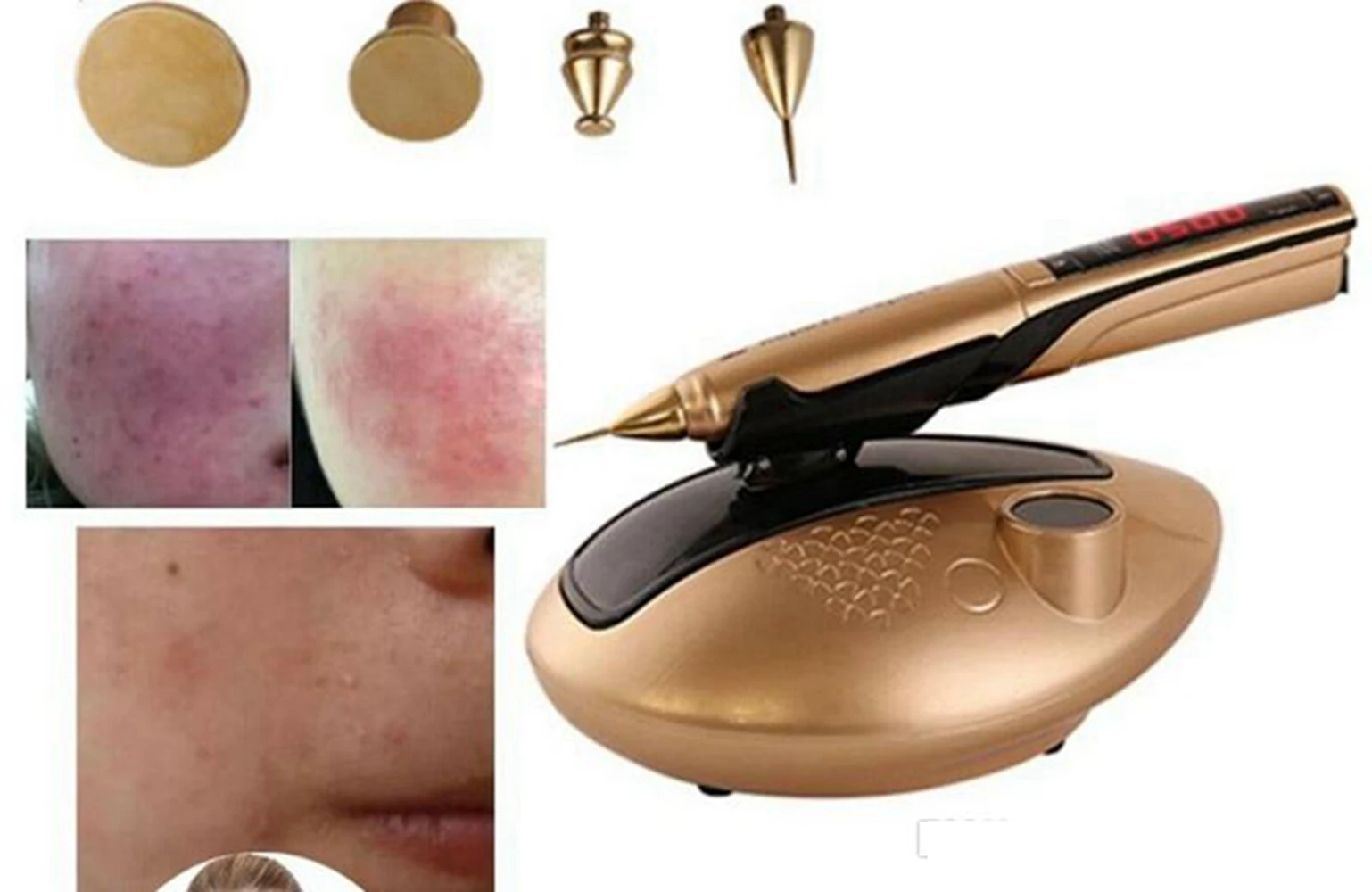 Gold Plasma Pen For Skin Tightening Facial Lifting Wrinkle Removal Mole Freckle Dark Spot Remover Plasma Pen Beauty Equipment