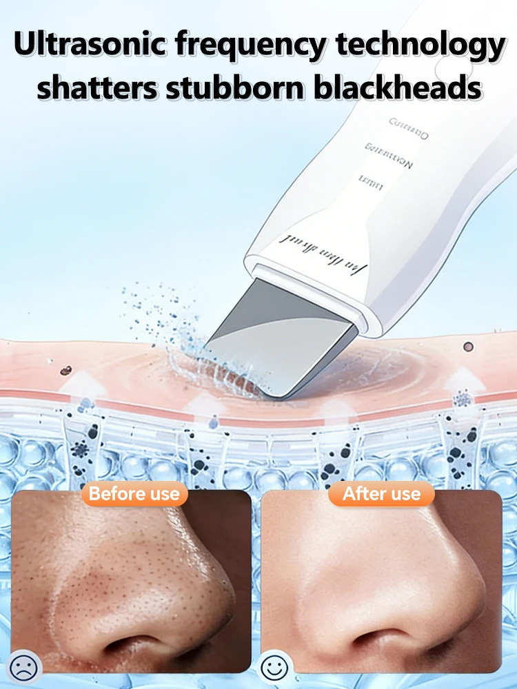 4 Modes Ultrasonic Skin Spatula Blackhead Remover Deep Cleansing Facial Scrubber Machine Oil Control Exfoliating Anti-Aging Skin - view 3