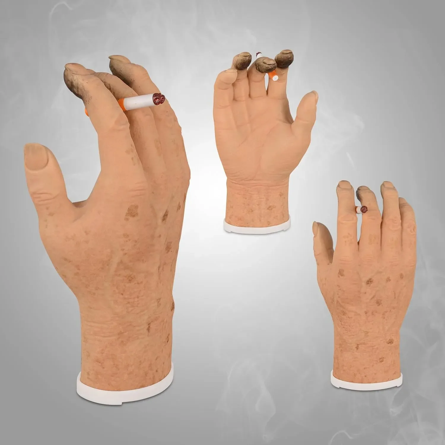 Ultrassist Smoking Hand Model Exposure Phenotype Pathology Display Rotating Magnetic Tray for Medical Education Health Teaching