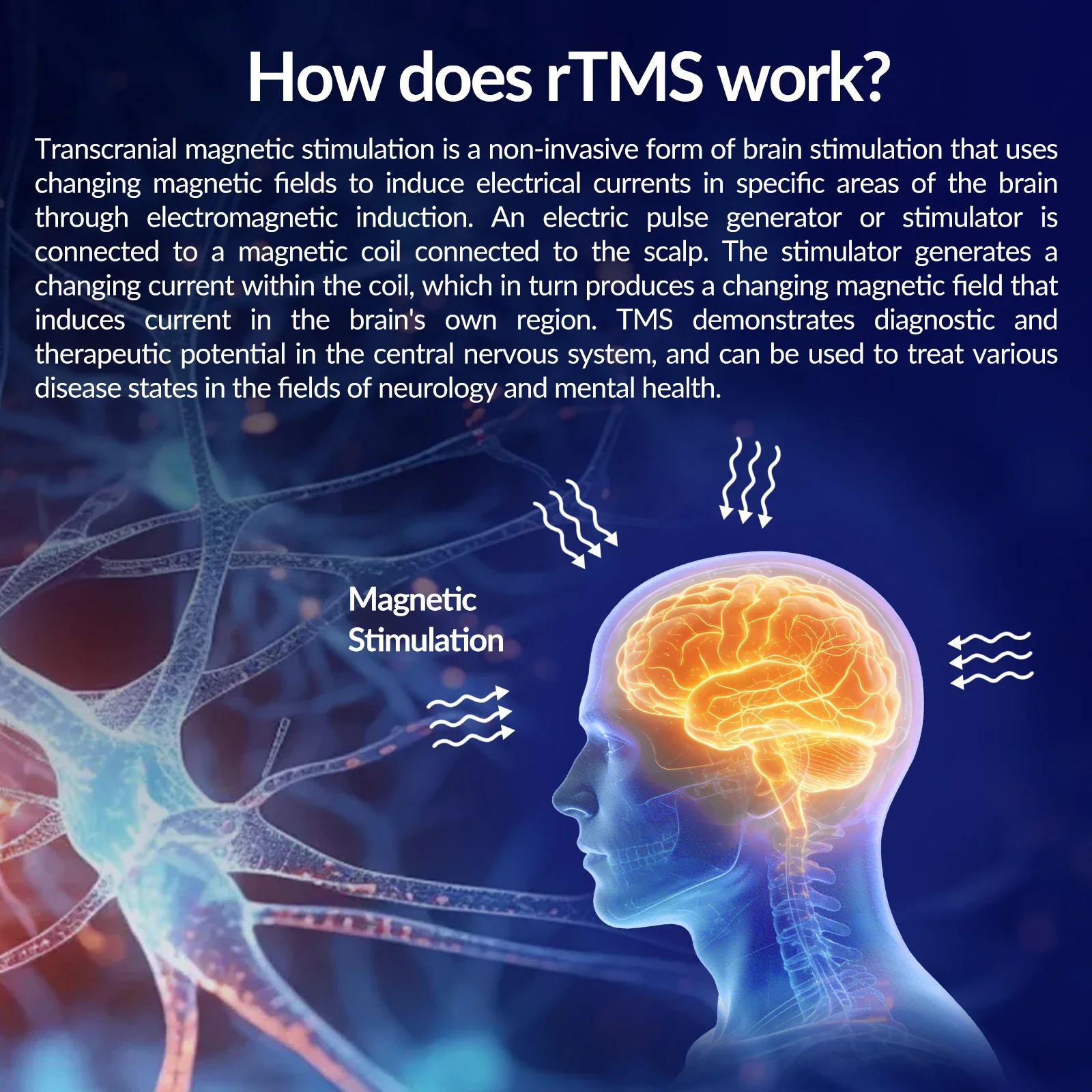 Non Invasive rTMS Transcranial Magnetic Stimulation Therapy Device for Headache Relief Sleep Quality Emotional Stability