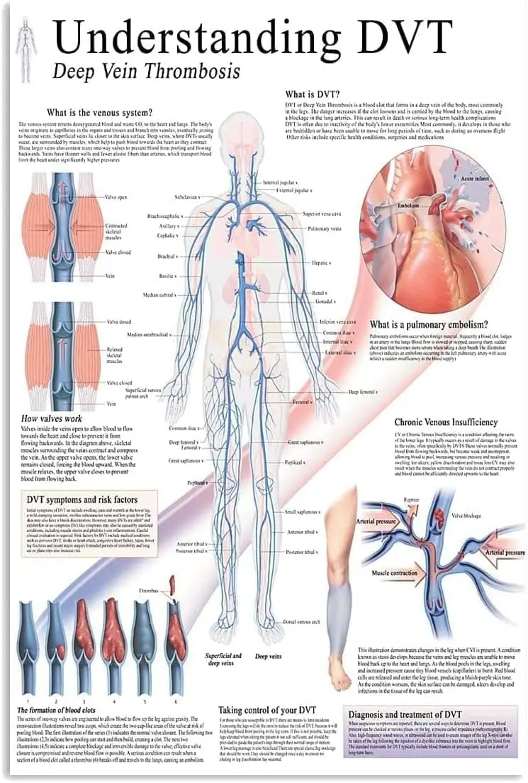 ESETASOT Vascular Knowledge Metal Signs Wall Decor Understanding Dvt Deep Vein Thrombosis Tin Posters Vascular Surgeon Offi sign