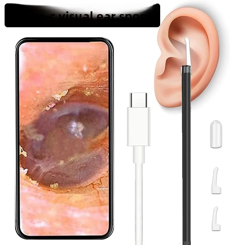 Type-C High-definition Visual Ear Spoon Endoscope Ear Cleaner