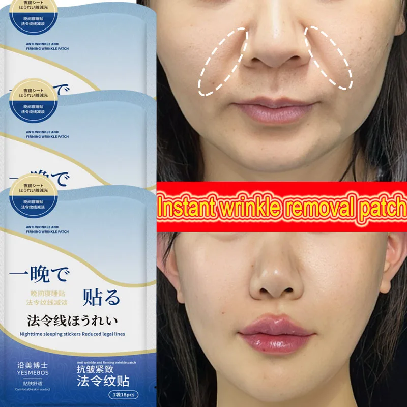 Kollagen-Nasolabialfalten-Patch mit Hyaluronsäure Sofort Straffende Haut Feine Linien Reduzierende Tiefenwirksame Feuchtigkeitsspendende Gesichtsmaske