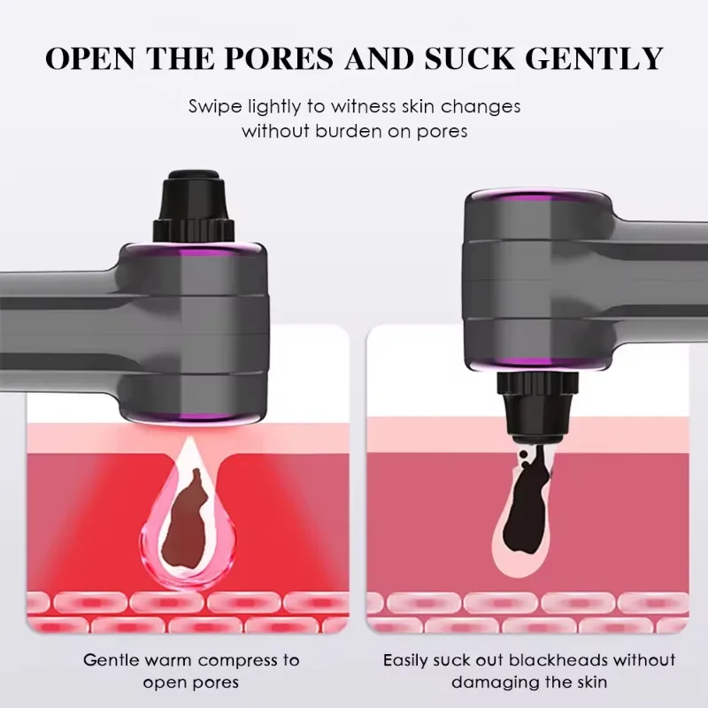 Elektryczny oczyszczacz porów twarzy, urządzenie do usuwania trądziku, podgrzewanie twarzy, mikropęcherze, próżniowy odkurzacz do wągrów ze stali nierdzewnej.