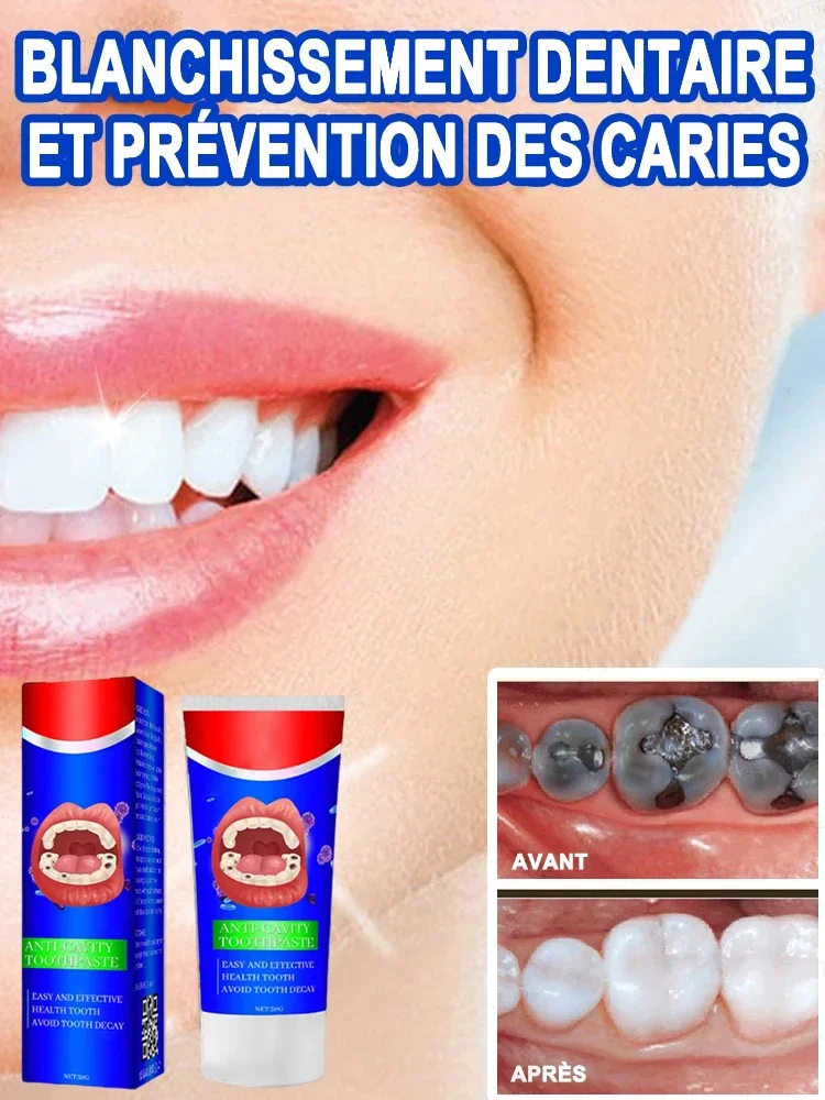 

Teeth Cleansing Whitening Mousse Whitening Teeth Remove tooth stains Clean mouth Fresh Breath Mousse Foam Portable toothpaste