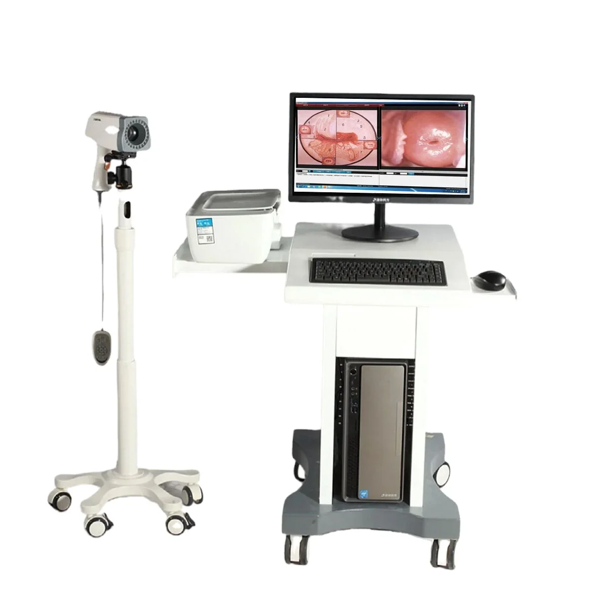 Colposcope For Gynecology Kernel KN-2200 Digital Colposcope Portable Vagina Colposcopy Price