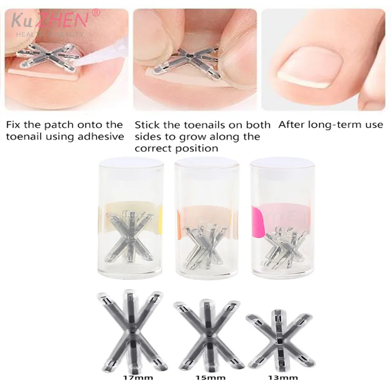 2Pc 13/17MM Ingrown Toenail Correction Tool Ingrown Toenail Treatments Elastic Patch Sticker Toenail Straightening Pedicure Tool