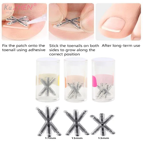 Imagen 1 del producto Herramienta de corrección de uñas encarnadas, 2 unidades, 13/17MM, tratamientos de uñas encarnadas, parche elástico, pegatina, herramienta de pedicura alisadora de uñas