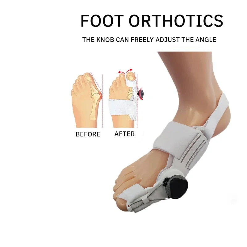 1PC Foot Corrector 3D Knob Adjustable Hallux Valgus Corrector Big Foot Bone Protrusion Overlapping Toe Separator Orthosis