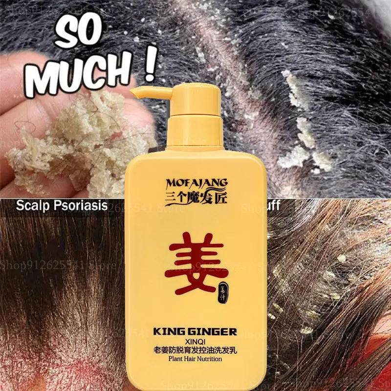 500ml Effectively Anti-hair Loss Plants Ginger Shampoo Baldness And Dandruff Moisturizes And Repairs Hair Care Grow Thick Growth