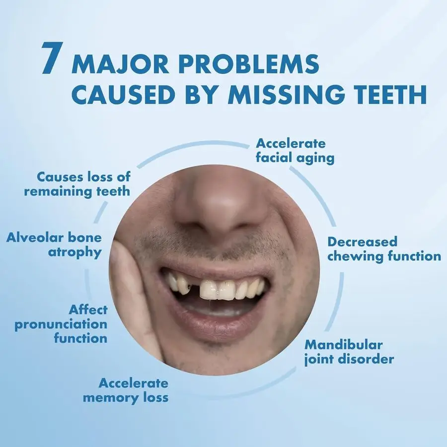 مجموعة استبدال الأسنان الشخصية القابلة للإزالة المخصصة لأطقم الأسنان المفقودة بفجوة 3 أسنان #6