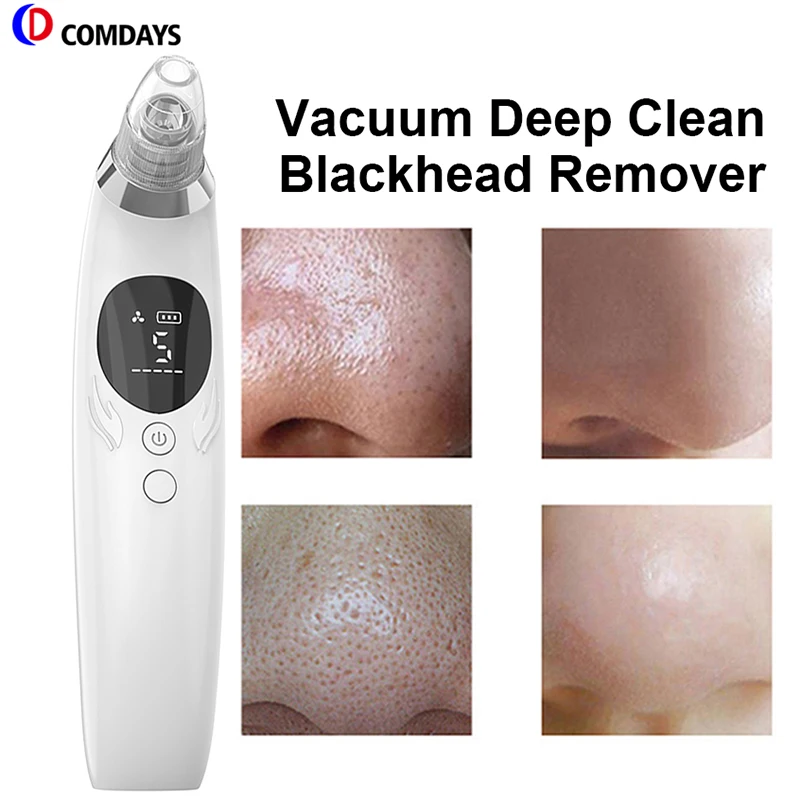 New Blackhead remover  Face cleaner Face scrubber Black dots Type-C Charging 5 Probes & Levels Face lifting machine