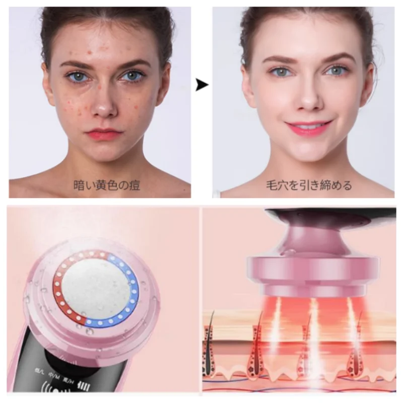 

High frequency Hifu rf Microcurrent face radio frequency lifting professional machine massager Microcurrents for facial device