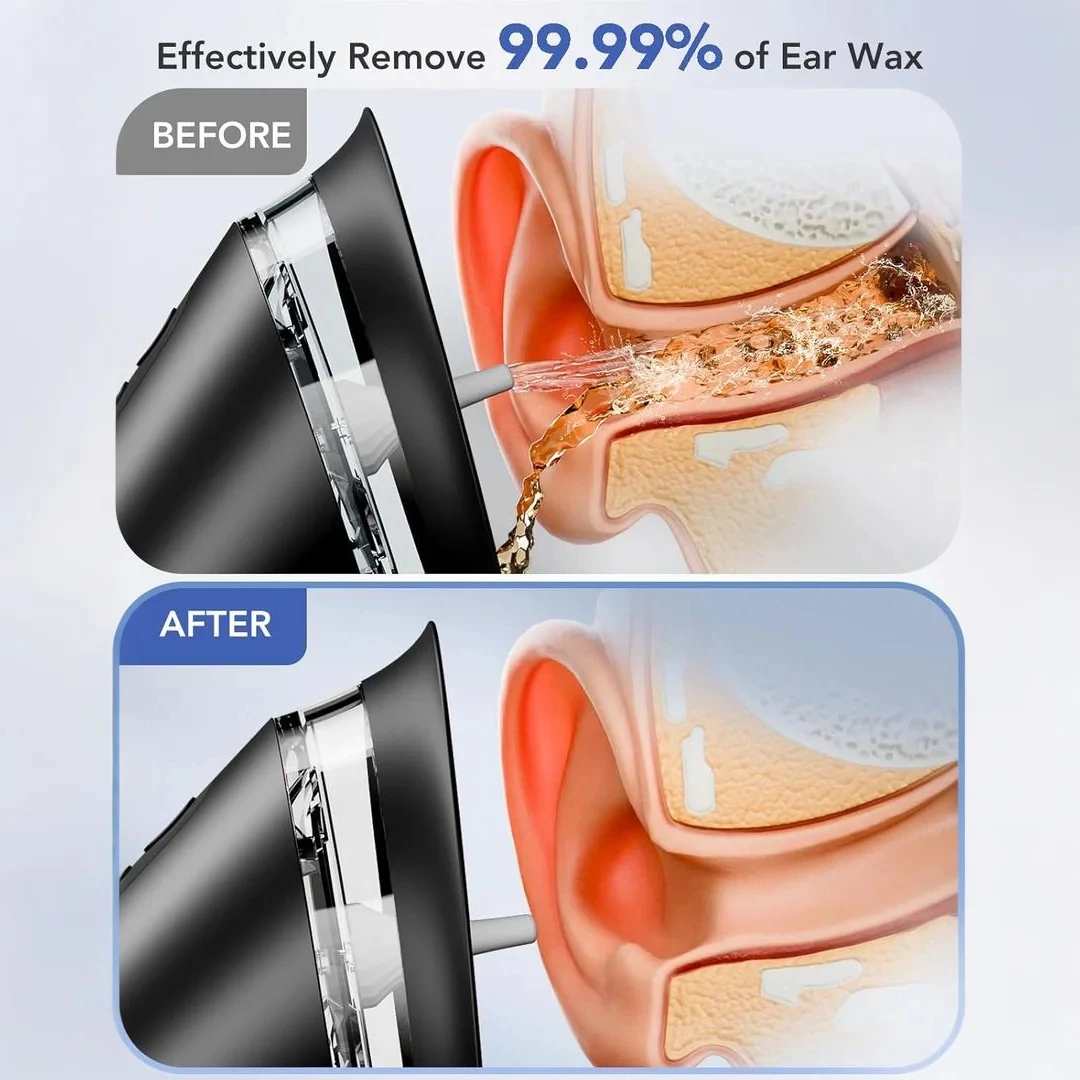 3 Mode Adjustable Electric Ear Wax Removal Kit Waterproof Ear Irrigation Washer Ear Cleaning Tool for Family Health Care Gifts