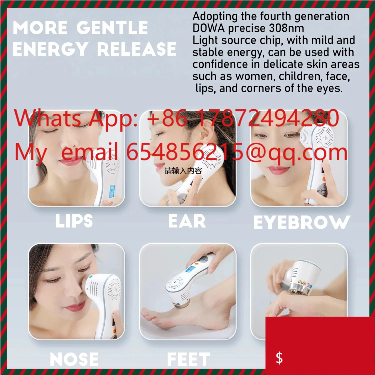 

KN-4003B3 Эксимерная фототерапия высокой мощности 308 нм для лечения витилиго и псориаза