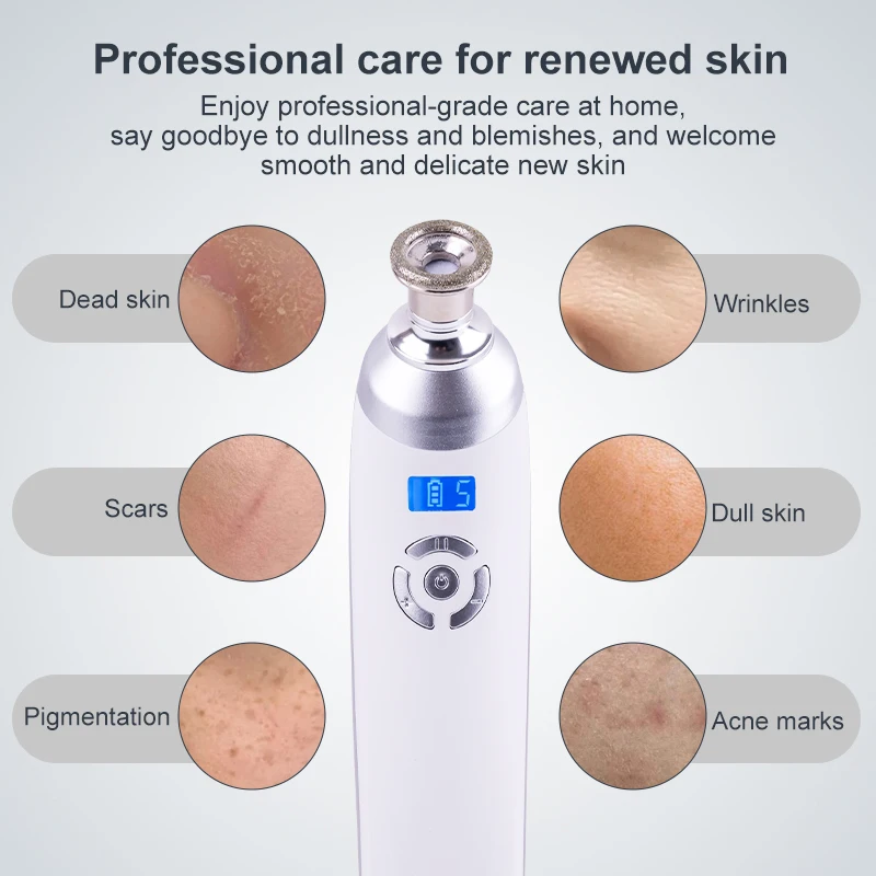 Lesen Beauty Draadloze diamantmicrokristalhuidpolijstmachine voor het verwijderen van mee-eters, diepe reiniging, anti-aging rimpelverzorgingstool