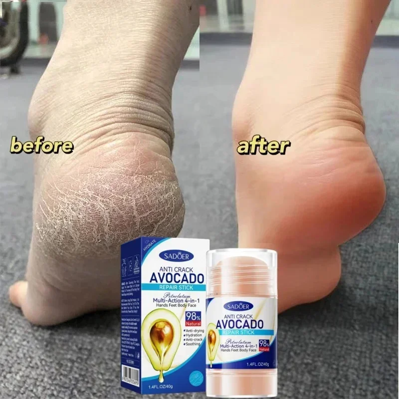 

Squalane Vaseline Foot Hand Care Cream Stick Used For Heel Care Deeply Moisturizing And Nourishing Your Dry Rough Skin T2U3