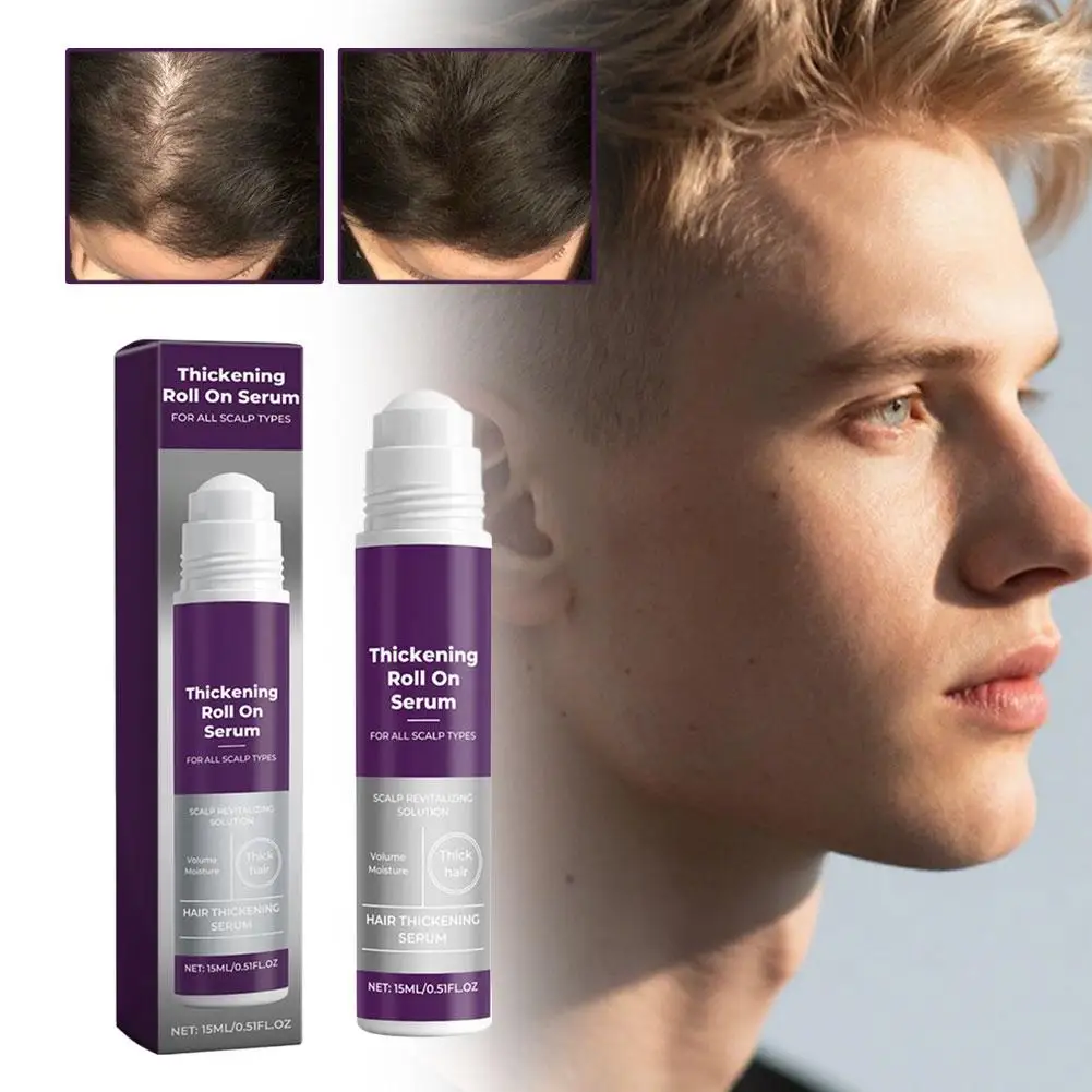 جوهر كرة دوارة مغذي للشعر يقوي جذور الشعر تحسين صحة الشعر العناية اللطيفة فروة الرأس لامعة العناية بالشعر جوهر لفة على #2