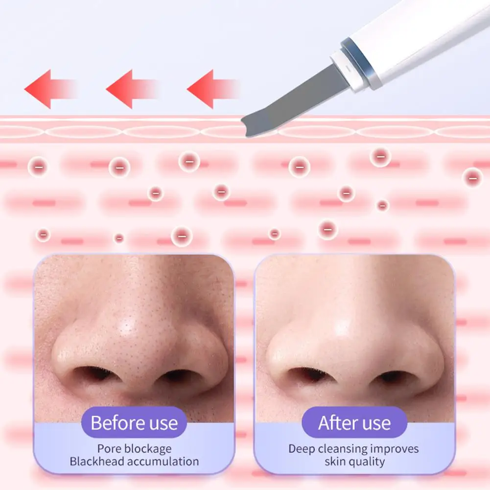 Ultradźwiękowy skrobak do skóry LED, lifting i ujędrnianie skóry, szpatułka EMS, jonowa głęboka oczyszczanie porów twarzy, urządzenie do usuwania zaskórników