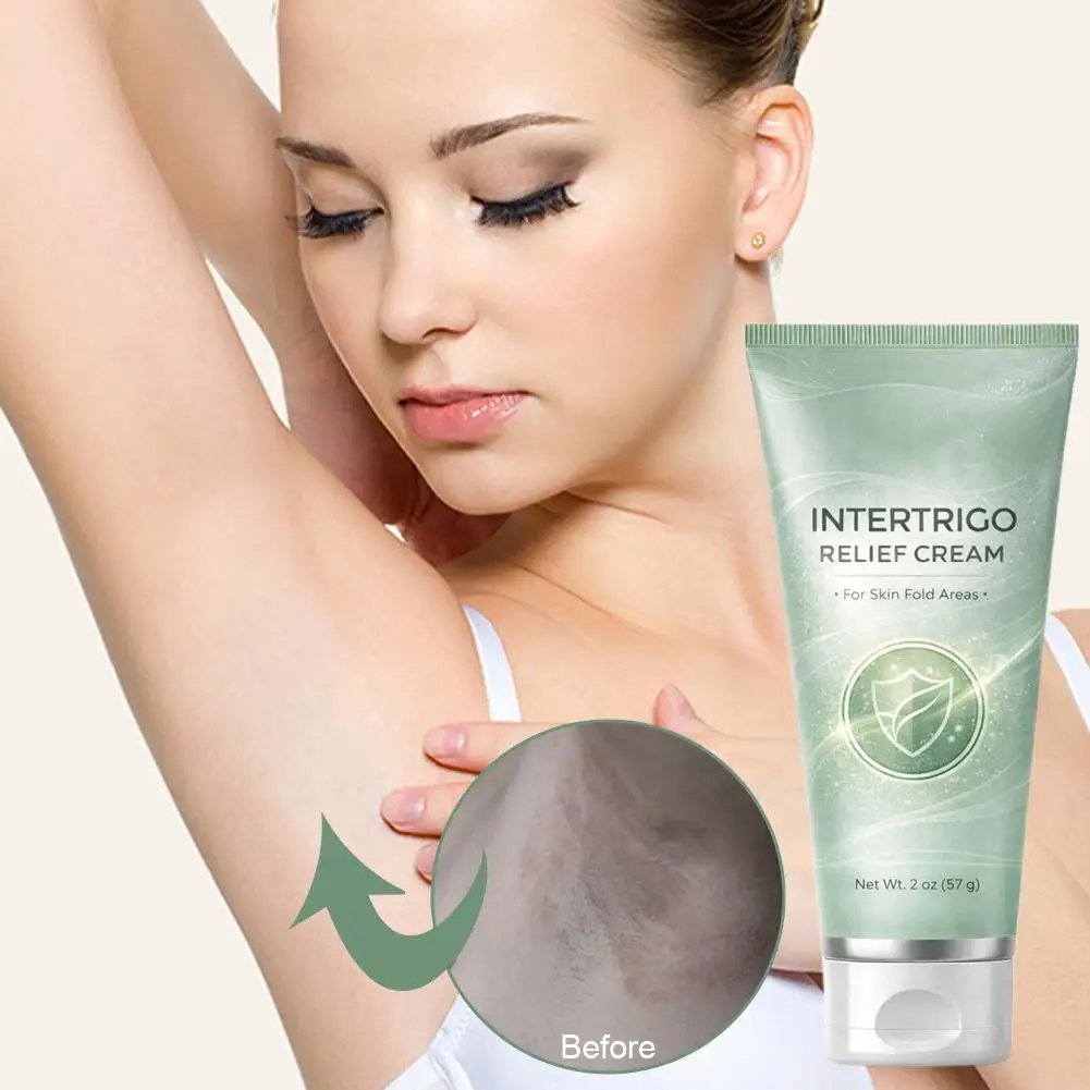 

Skin Fold Care Cream Soothe Redness Irritation Moisture Control Friction Protection Lightweight Body Balm for Sensitive Skin