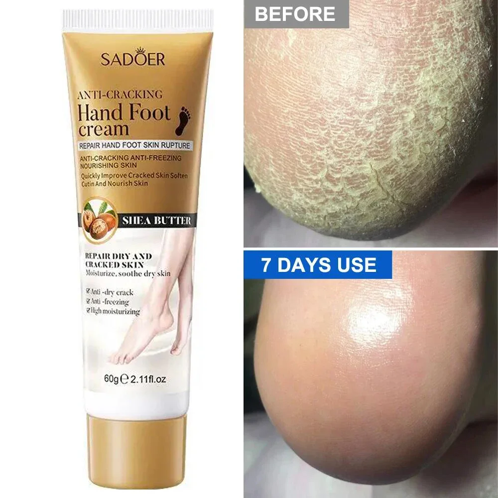 Anti Crack Hand Foot Cream Anti-Drying Heel Cracked Repairs Feet Mask Removal Dead Skin Moisturizing Whitening Smooth Feet Care