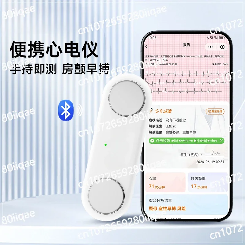 Medical electrocardiogram detector ECG monitor heart rate heart home portable dynamic atrial fibrillation premature beat