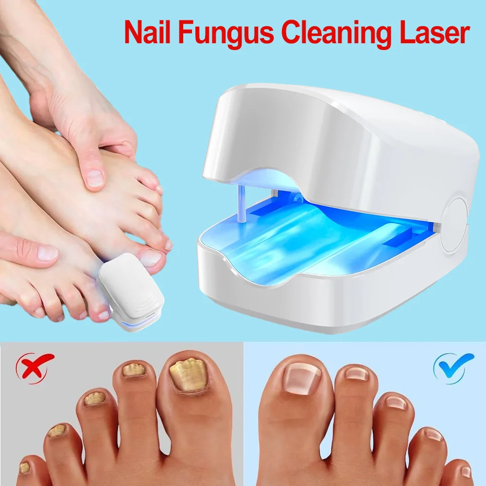 Dispositivo do tratamento do laser do fungo do prego, Reparo da unha, Unha Fungus Treat, Unhas do laser do onicomicose com relaxamento dos cogumelos