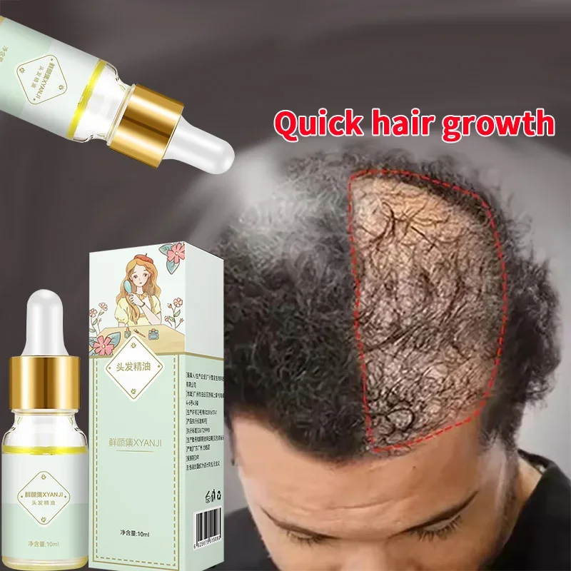 

Fast Hair Growth Serum Anti Hair Loss Prevent Baldness Scalp Treatment Repair Roots Beauty Health Hair Care For Men Women