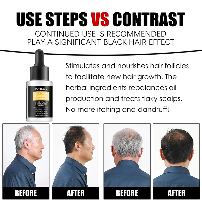 Gray White Hair Treatment Serum White Black Natural Color Hair Growth Oils Fast Regrowth Anti Hair Loss Beauty Health Women Men