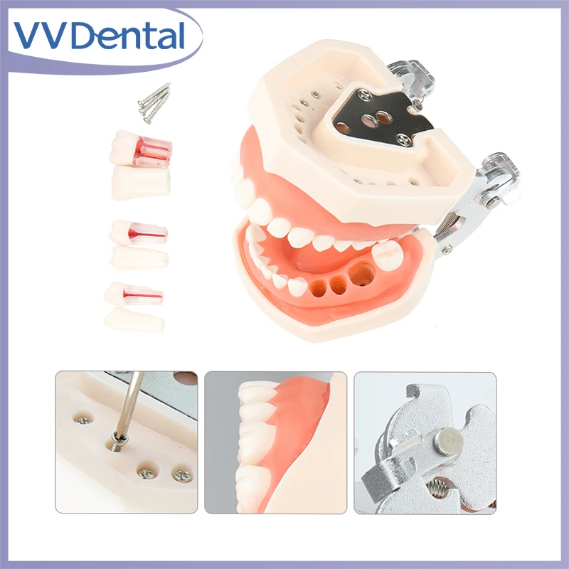 

VVDental 28/32 Teeth Model For Dental Technician Practice Training Jaw Typodont Standard Dental Model Teeth Teaching Model