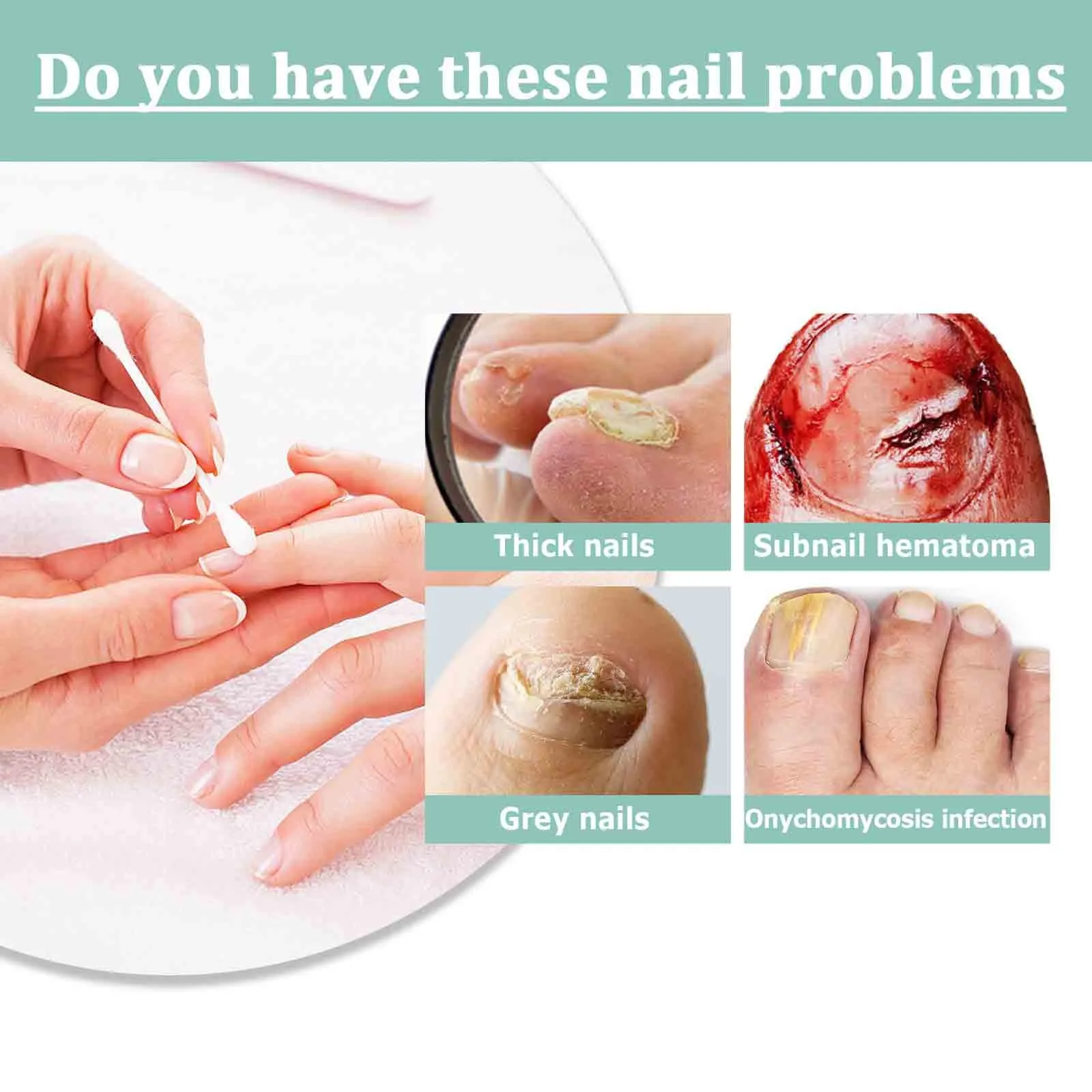 Nail TreatmentPen Nail Cuticle Oil Damaged Nail Pen Nail Strengthening Cuticle Revitalizer Oil Prevent Agnail Nail Polish