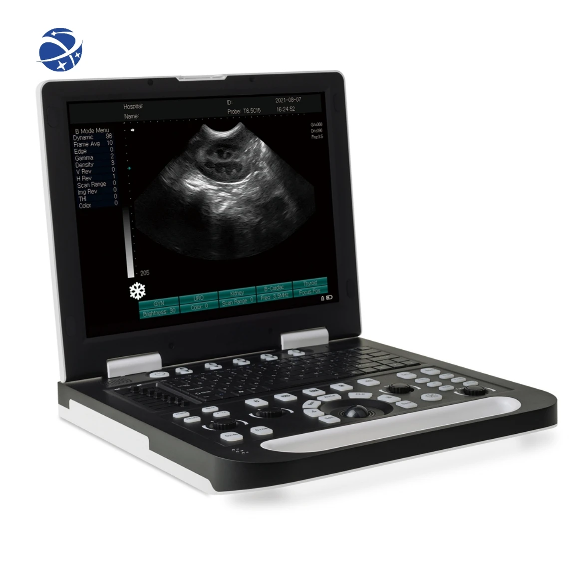 Low Price Echo Advance Vet Veterinary Portable for Human Being 4D Ultrasound Scanner