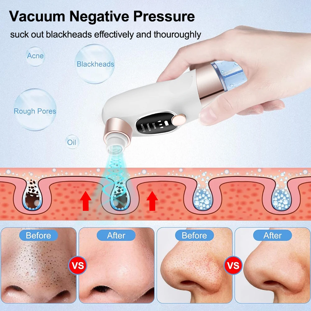 Aspirateur électrique Rechargeable pour points noirs, nettoyeur de pores du visage, nettoyeur de boutons et de points noirs, Machine de nettoyage en profondeur de la peau