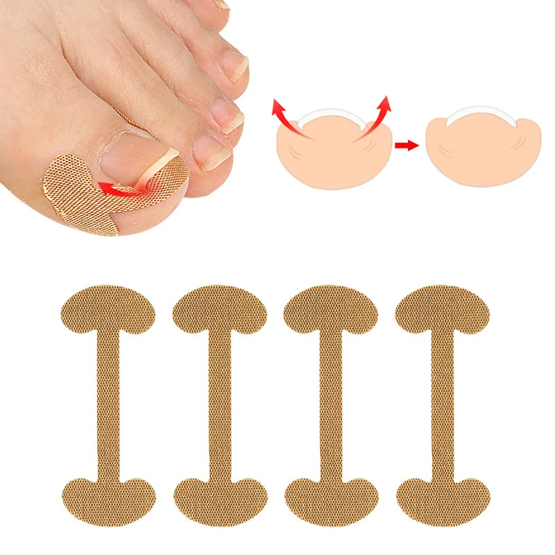 8Pcs=2Sheets Ingrown Toenail Correction Sticker Adhesive Toenail Patch Foot Care Pedicure Elastic Treatment Corrector Sticker