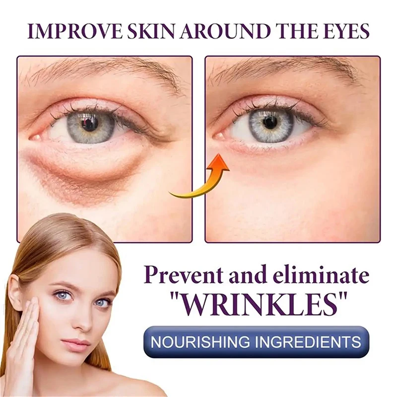 Fat Granules Removal Eyestick Anti-Puffiness Firming Cream Anti Inflammatory Fade Fine Line Skin Care Beauty Health Product