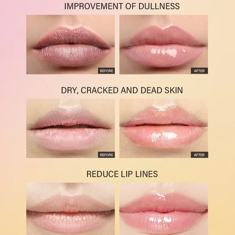 Peptídeo tratamento labial hidratante máscara labial gel para remover pele morta batom base odor de frutas creme labial reparação máscara de cuidados com os lábios 10ml