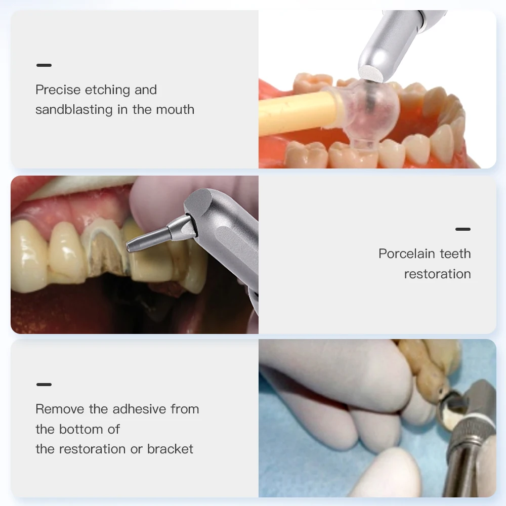 AZDENT Dental Aluminum Oxide Micro Blaster Interface Microetcher Sandblasting Alumina Gun Air Abrasion Polisher Dentistry Tools